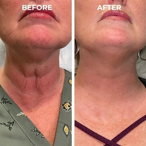 Az akció utolsó napja 70%-al OLCSÓBB - 🔥Botox arcszérum